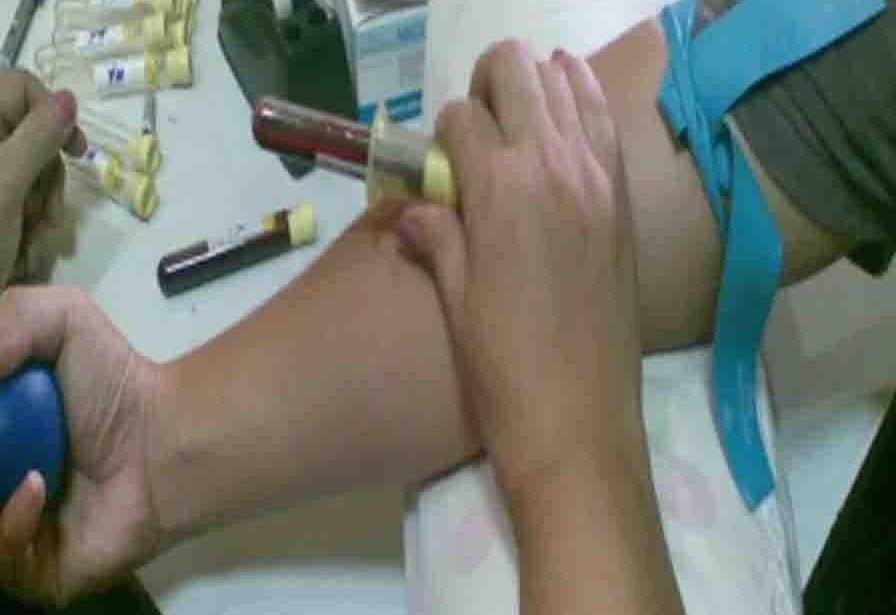 Lymphocyte Immunization Therapy